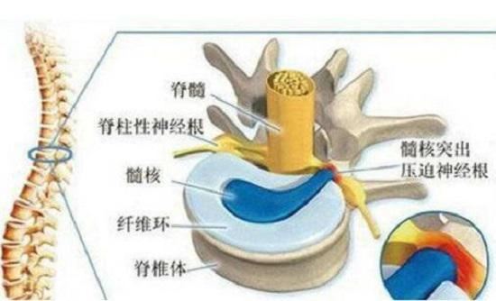 颈椎牵引的角度、力度和时间(上海灰指甲医院)图1