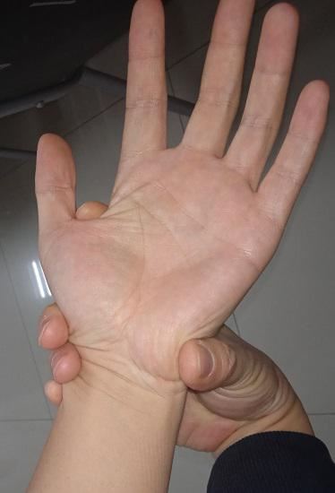 握住患者的手（蚓状肌抓握法）