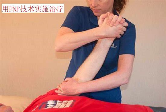 用PNF技术实施治疗 用PNF技术实施治疗