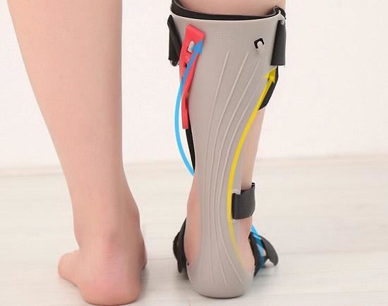足踝矫形器