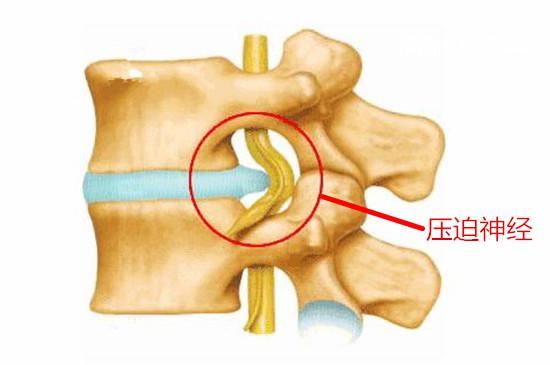 几个常见的“毁腰”锻炼法(十八大是什么意思)图1