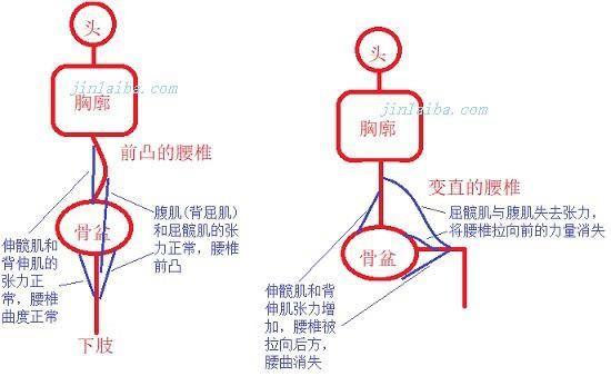 正常的腰椎和坐立时的腰椎