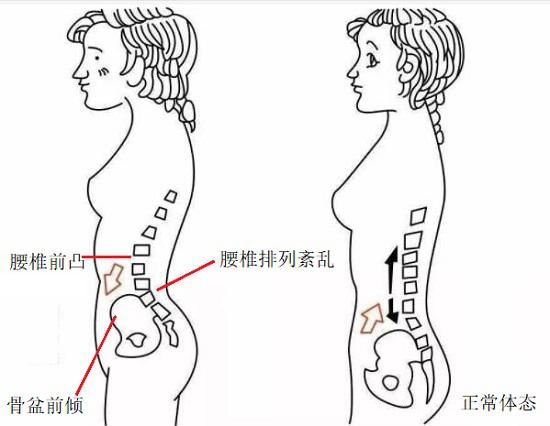 产后腰痛的原因及应对方法(夏日甜心演员表)