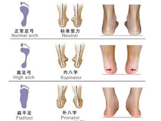 足弓与运动功能障碍