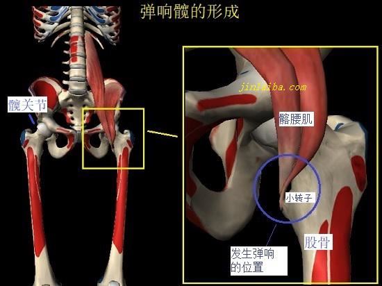 大腿内侧隐隐作痛？可能是“弹响髋”惹的祸(李晟张睿结婚图1