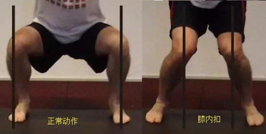 膝、踝关节异常的“运动模式”