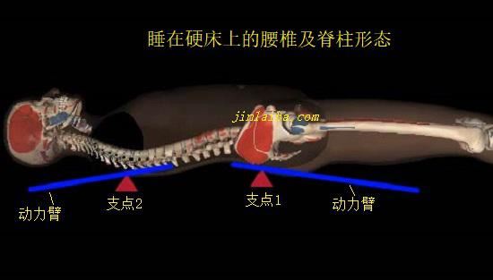 仰卧时的正常腰曲