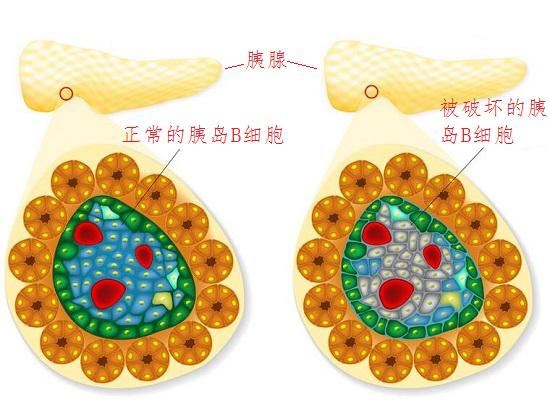 胰腺与胰岛