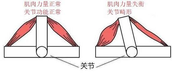 久坐工作者：一个动作帮你找到身体隐患图1