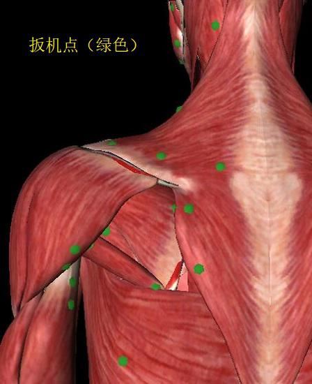 一些比较多见且固定的肌肉痛点（扳机点）