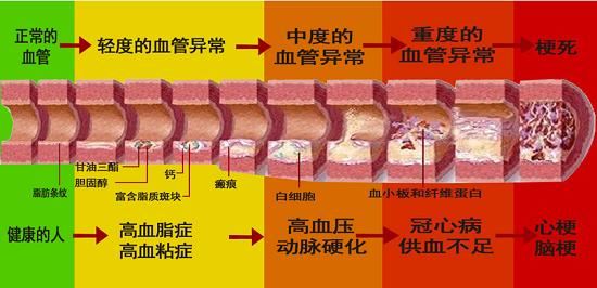 血管硬化的程度